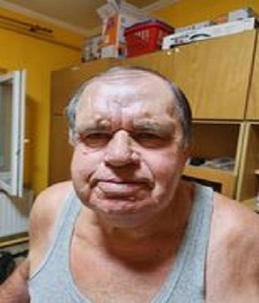 István